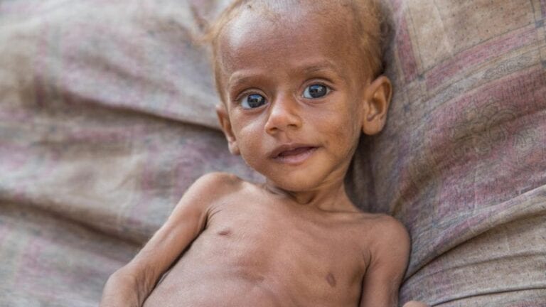 Children Starving to Death and  ignored